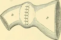 Picture 297 of 481 from Modern surgery, general and operative / by John Chalmers Da Costa. (1907), leaf 947