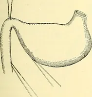 An illustration from Modern surgery, general and operative / by John Chalmers Da Costa. (1907)