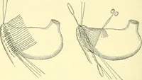 Picture 299 of 481 from Modern surgery, general and operative / by John Chalmers Da Costa. (1907), leaf 948