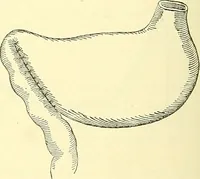 Picture 300 of 481 from Modern surgery, general and operative / by John Chalmers Da Costa. (1907), leaf 948
