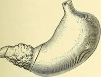 Picture 301 of 481 from Modern surgery, general and operative / by John Chalmers Da Costa. (1907), leaf 949