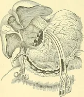 Picture 303 of 481 from Modern surgery, general and operative / by John Chalmers Da Costa. (1907), leaf 949