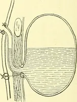 Picture 307 of 481 from Modern surgery, general and operative / by John Chalmers Da Costa. (1907), leaf 954