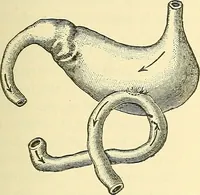 Picture 308 of 481 from Modern surgery, general and operative / by John Chalmers Da Costa. (1907), leaf 957