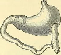 Picture 309 of 481 from Modern surgery, general and operative / by John Chalmers Da Costa. (1907), leaf 957