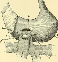 Picture 311 of 481 from Modern surgery, general and operative / by John Chalmers Da Costa. (1907), leaf 959