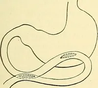 Picture 315 of 481 from Modern surgery, general and operative / by John Chalmers Da Costa. (1907), leaf 961