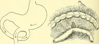 Picture 317 of 481 from Modern surgery, general and operative / by John Chalmers Da Costa. (1907), leaf 962