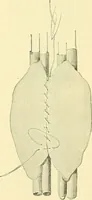Picture 319 of 481 from Modern surgery, general and operative / by John Chalmers Da Costa. (1907), leaf 965