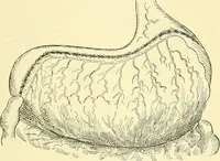 Picture 322 of 481 from Modern surgery, general and operative / by John Chalmers Da Costa. (1907), leaf 969