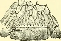 Picture 323 of 481 from Modern surgery, general and operative / by John Chalmers Da Costa. (1907), leaf 972