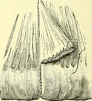 An illustration from Modern surgery, general and operative / by John Chalmers Da Costa. (1907)