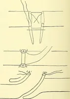 An illustration from Modern surgery, general and operative / by John Chalmers Da Costa. (1907)