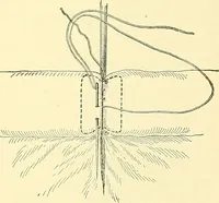 Picture 327 of 481 from Modern surgery, general and operative / by John Chalmers Da Costa. (1907), leaf 975