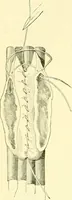 Picture 332 of 481 from Modern surgery, general and operative / by John Chalmers Da Costa. (1907), leaf 978