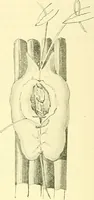 Picture 334 of 481 from Modern surgery, general and operative / by John Chalmers Da Costa. (1907), leaf 978