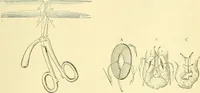 Picture 335 of 481 from Modern surgery, general and operative / by John Chalmers Da Costa. (1907), leaf 979