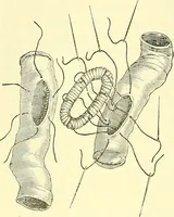 Picture 336 of 481 from Modern surgery, general and operative / by John Chalmers Da Costa. (1907), leaf 980