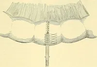 An illustration from Modern surgery, general and operative / by John Chalmers Da Costa. (1907)