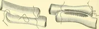 Picture 340 of 481 from Modern surgery, general and operative / by John Chalmers Da Costa. (1907), leaf 982