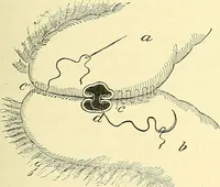 An illustration from Modern surgery, general and operative / by John Chalmers Da Costa. (1907)