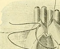 Picture 344 of 481 from Modern surgery, general and operative / by John Chalmers Da Costa. (1907), leaf 985