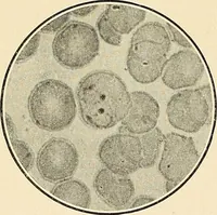 An illustration from The malarial fevers, haemoglobinuric fever and the blood protozoa of man / by Charles F. Craig ; illustrated by four colored plates, twenty-five clinical charts, and twenty-eight photomicrographs and drawings. (1909)