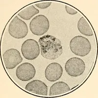 An illustration from The malarial fevers, haemoglobinuric fever and the blood protozoa of man / by Charles F. Craig ; illustrated by four colored plates, twenty-five clinical charts, and twenty-eight photomicrographs and drawings. (1909)