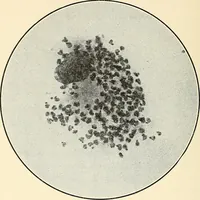 An illustration from The malarial fevers, haemoglobinuric fever and the blood protozoa of man / by Charles F. Craig ; illustrated by four colored plates, twenty-five clinical charts, and twenty-eight photomicrographs and drawings. (1909)