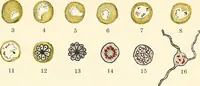 An illustration from The malarial fevers, haemoglobinuric fever and the blood protozoa of man / by Charles F. Craig ; illustrated by four colored plates, twenty-five clinical charts, and twenty-eight photomicrographs and drawings. (1909)