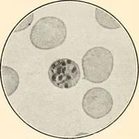 An illustration from The malarial fevers, haemoglobinuric fever and the blood protozoa of man / by Charles F. Craig ; illustrated by four colored plates, twenty-five clinical charts, and twenty-eight photomicrographs and drawings. (1909)