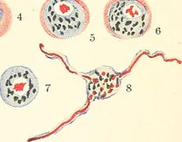 An illustration from The malarial fevers, haemoglobinuric fever and the blood protozoa of man / by Charles F. Craig ; illustrated by four colored plates, twenty-five clinical charts, and twenty-eight photomicrographs and drawings. (1909)