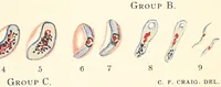 Picture 15 of 34 from The malarial fevers, haemoglobinuric fever and the blood protozoa of man / by Charles F. Craig ; illustrated by four colored plates, twenty-five clinical charts, and twenty-eight photomicrographs and drawings. (1909), leaf 73