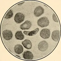 An illustration from The malarial fevers, haemoglobinuric fever and the blood protozoa of man / by Charles F. Craig ; illustrated by four colored plates, twenty-five clinical charts, and twenty-eight photomicrographs and drawings. (1909)
