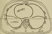An illustration from The diagnostics of internal medicine : a clinical treatise upon the recognised principles of medical diagnosis, prepared for the use of students and practitioners of medicine / by Glentworth Reeve Butler ... ; with five coloured plates and two hundred and seventy-two illustrations and charts in the text. (1909)