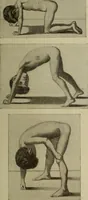 An illustration from The diagnostics of internal medicine : a clinical treatise upon the recognised principles of medical diagnosis, prepared for the use of students and practitioners of medicine / by Glentworth Reeve Butler ... ; with five coloured plates and two hundred and seventy-two illustrations and charts in the text. (1909)