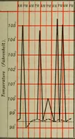 An illustration from The diagnostics of internal medicine : a clinical treatise upon the recognised principles of medical diagnosis, prepared for the use of students and practitioners of medicine / by Glentworth Reeve Butler ... ; with five coloured plates and two hundred and seventy-two illustrations and charts in the text. (1909)