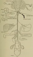 An illustration from The diagnostics of internal medicine : a clinical treatise upon the recognised principles of medical diagnosis, prepared for the use of students and practitioners of medicine / by Glentworth Reeve Butler ... ; with five coloured plates and two hundred and seventy-two illustrations and charts in the text. (1909)