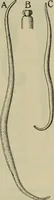 An illustration from The diagnostics of internal medicine : a clinical treatise upon the recognised principles of medical diagnosis, prepared for the use of students and practitioners of medicine / by Glentworth Reeve Butler ... ; with five coloured plates and two hundred and seventy-two illustrations and charts in the text. (1909)