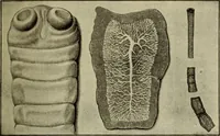 An illustration from The diagnostics of internal medicine : a clinical treatise upon the recognised principles of medical diagnosis, prepared for the use of students and practitioners of medicine / by Glentworth Reeve Butler ... ; with five coloured plates and two hundred and seventy-two illustrations and charts in the text. (1909)