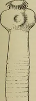 An illustration from The diagnostics of internal medicine : a clinical treatise upon the recognised principles of medical diagnosis, prepared for the use of students and practitioners of medicine / by Glentworth Reeve Butler ... ; with five coloured plates and two hundred and seventy-two illustrations and charts in the text. (1909)