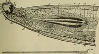 An illustration from The diagnostics of internal medicine : a clinical treatise upon the recognised principles of medical diagnosis, prepared for the use of students and practitioners of medicine / by Glentworth Reeve Butler ... ; with five coloured plates and two hundred and seventy-two illustrations and charts in the text. (1909)