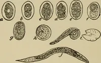 An illustration from The diagnostics of internal medicine : a clinical treatise upon the recognised principles of medical diagnosis, prepared for the use of students and practitioners of medicine / by Glentworth Reeve Butler ... ; with five coloured plates and two hundred and seventy-two illustrations and charts in the text. (1909)