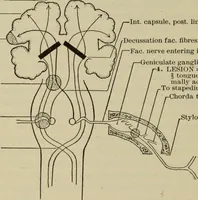 An illustration from The diagnostics of internal medicine : a clinical treatise upon the recognised principles of medical diagnosis, prepared for the use of students and practitioners of medicine / by Glentworth Reeve Butler ... ; with five coloured plates and two hundred and seventy-two illustrations and charts in the text. (1909)