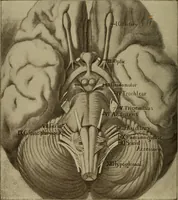 An illustration from The diagnostics of internal medicine : a clinical treatise upon the recognised principles of medical diagnosis, prepared for the use of students and practitioners of medicine / by Glentworth Reeve Butler ... ; with five coloured plates and two hundred and seventy-two illustrations and charts in the text. (1909)