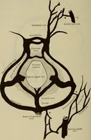 An illustration from The diagnostics of internal medicine : a clinical treatise upon the recognised principles of medical diagnosis, prepared for the use of students and practitioners of medicine / by Glentworth Reeve Butler ... ; with five coloured plates and two hundred and seventy-two illustrations and charts in the text. (1909)