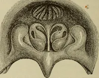 An illustration from The diagnostics of internal medicine : a clinical treatise upon the recognised principles of medical diagnosis, prepared for the use of students and practitioners of medicine / by Glentworth Reeve Butler ... ; with five coloured plates and two hundred and seventy-two illustrations and charts in the text. (1909)