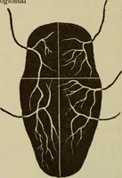 An illustration from The diagnostics of internal medicine : a clinical treatise upon the recognised principles of medical diagnosis, prepared for the use of students and practitioners of medicine / by Glentworth Reeve Butler ... ; with five coloured plates and two hundred and seventy-two illustrations and charts in the text. (1909)