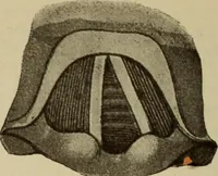 An illustration from The diagnostics of internal medicine : a clinical treatise upon the recognised principles of medical diagnosis, prepared for the use of students and practitioners of medicine / by Glentworth Reeve Butler ... ; with five coloured plates and two hundred and seventy-two illustrations and charts in the text. (1909)