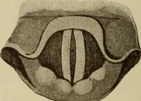 An illustration from The diagnostics of internal medicine : a clinical treatise upon the recognised principles of medical diagnosis, prepared for the use of students and practitioners of medicine / by Glentworth Reeve Butler ... ; with five coloured plates and two hundred and seventy-two illustrations and charts in the text. (1909)